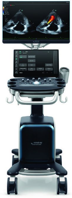 Mindray Vetus 80 Advanced Set – Premium-Ultraschallgerät für den Abdomen- und Kardioultraschall