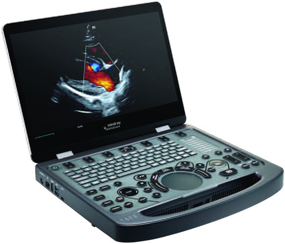 Mindray Vetus E5 Set – Portabel, einfach zu bedienen, leistungsstarke Bildgebung