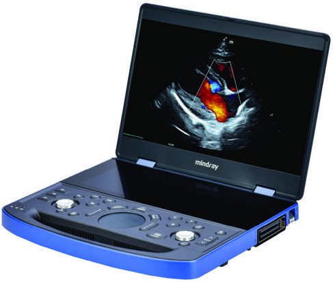Mindray Vetus E7 Advanced Set – Portables Ultraschallsystem für Praxis und Hausbesuch